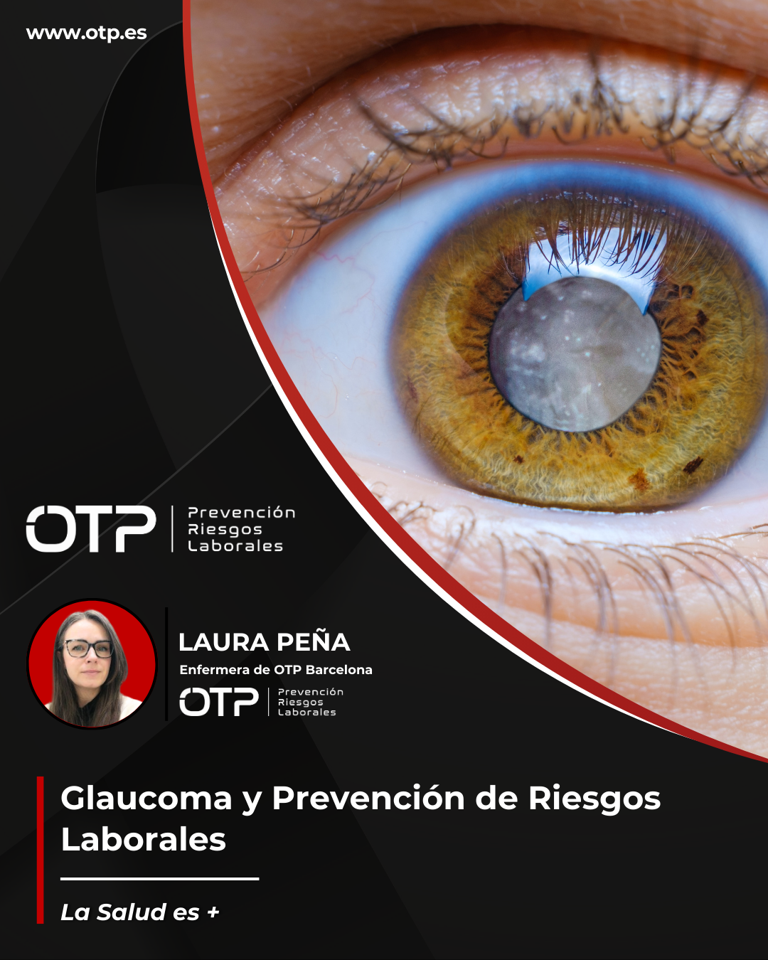 Glaucoma y Prevención de Riesgos Laborales