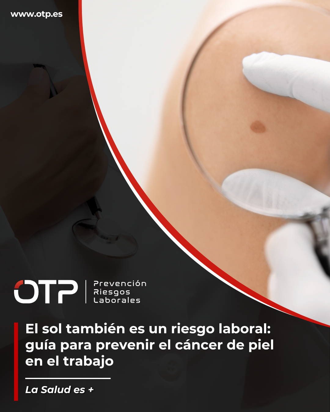 El sol también es un riesgo laboral: guía para prevenir el cáncer de piel en el trabajo